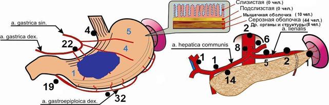 схема метастазирования3