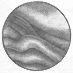 гастроскопическая картина нормального желудка