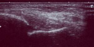 C:\Users\\Documents\  \2008-02 ()\0002.jpg