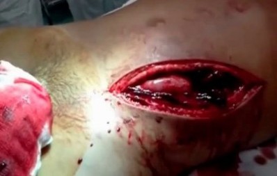 C:\Documents and Settings\Юра\Local Settings\Temporary Internet Files\Content.Word\рана живота.jpg